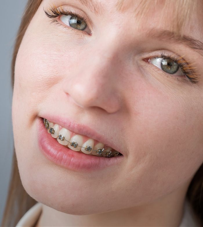 Treatment - Reading Dental Spa